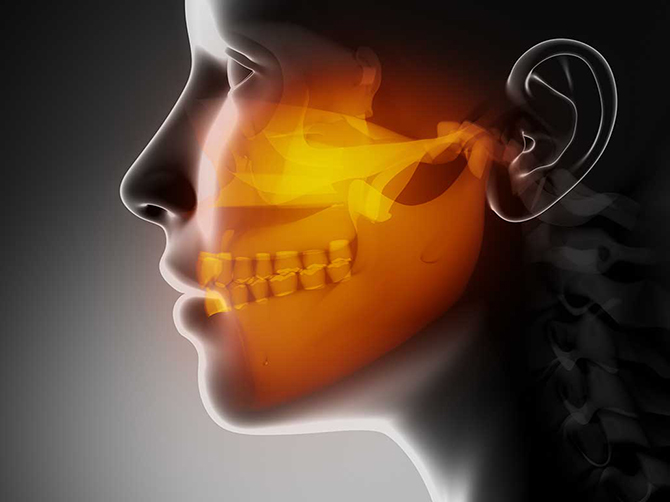 TMJ Disorders